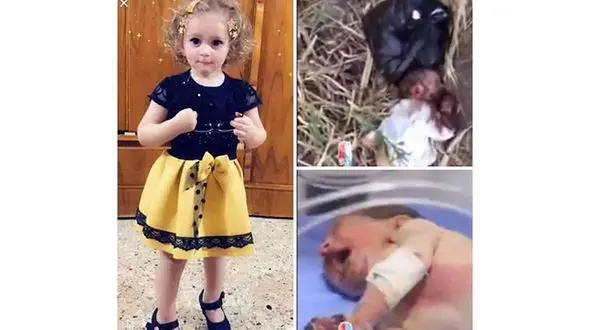 موش ها دستان این دختر خوش سیما را خوردند ! + عکس های دلخراش 