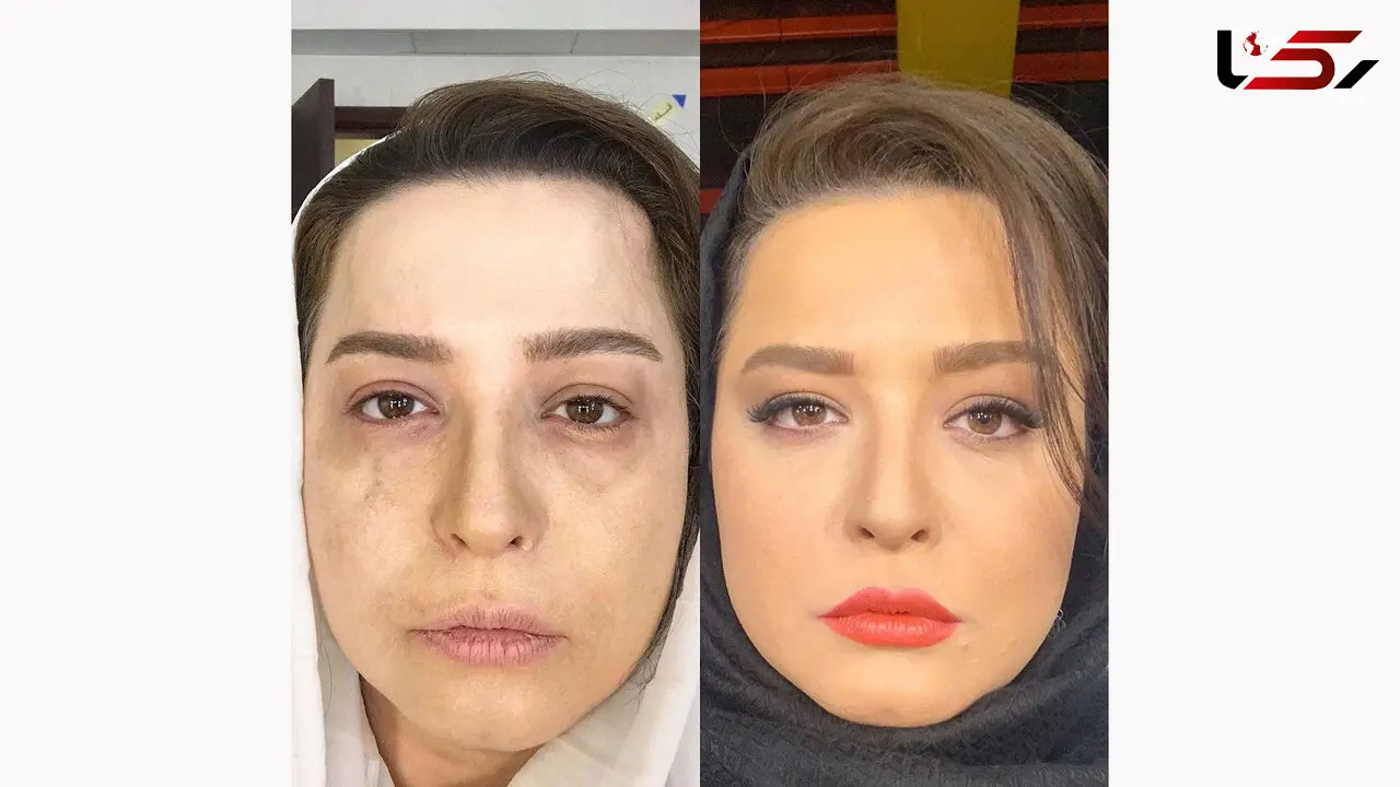 گریم قبل و بعد از خودکشی خانم بازیگر سریال "دل"