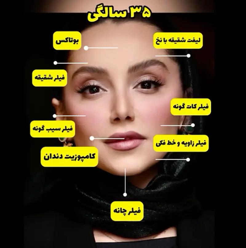 سیر تغییر چهره نازنین بیاتی