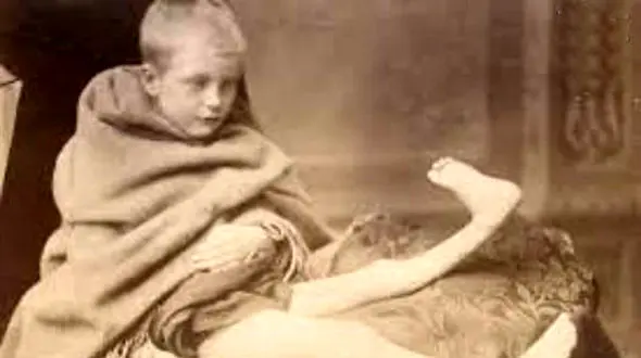 عجیب‌ترین و جالب‌ترین ترس‌ها که باورش برایتان دشوار است!+ تصاویر
