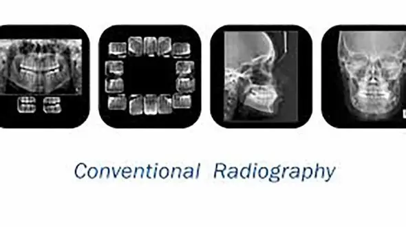 مراکز عکس  opg در تهران