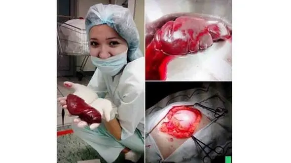 سلفی های خانم پرستار  با اعضای بدن مریض‌ها + عکس