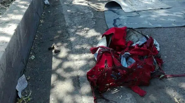 آتش زدن یک پسر در فردیس کرج 