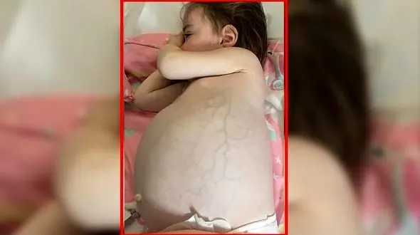 راز شکم برآمده دختر بچه مو بلوند چه بود؟ / همه اشتباه فکر می کردند!+عکس