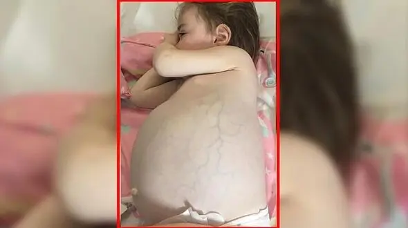 راز شکم برآمده دختر بچه مو بلوند چه بود؟ / همه اشتباه فکر می کردند!+عکس