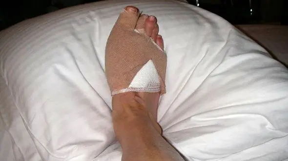 دختران ایرانی که پا در کفش سیندرلا می کنند/جراحی های چندش آور