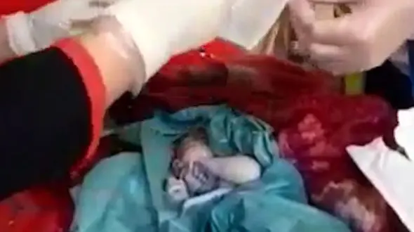 فیلم تاسفبار زایمان مخفی در سرویس بهداشتی / در کلینیک تالش رخ داد + عکس