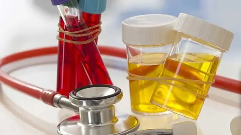 specific gravity در آزمایش ادرار نشانه چیست