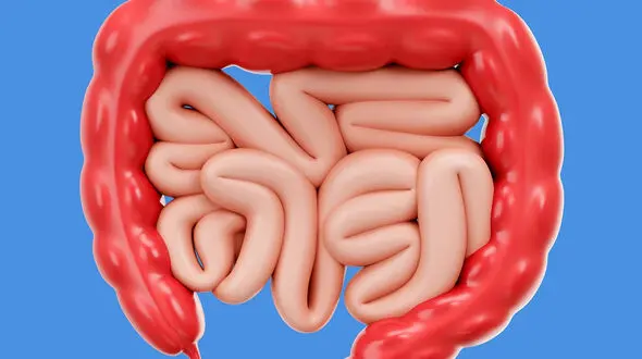 التهاب روده چیست؟ / از علت و انواع التهاب روده تا درمان و علائم آن