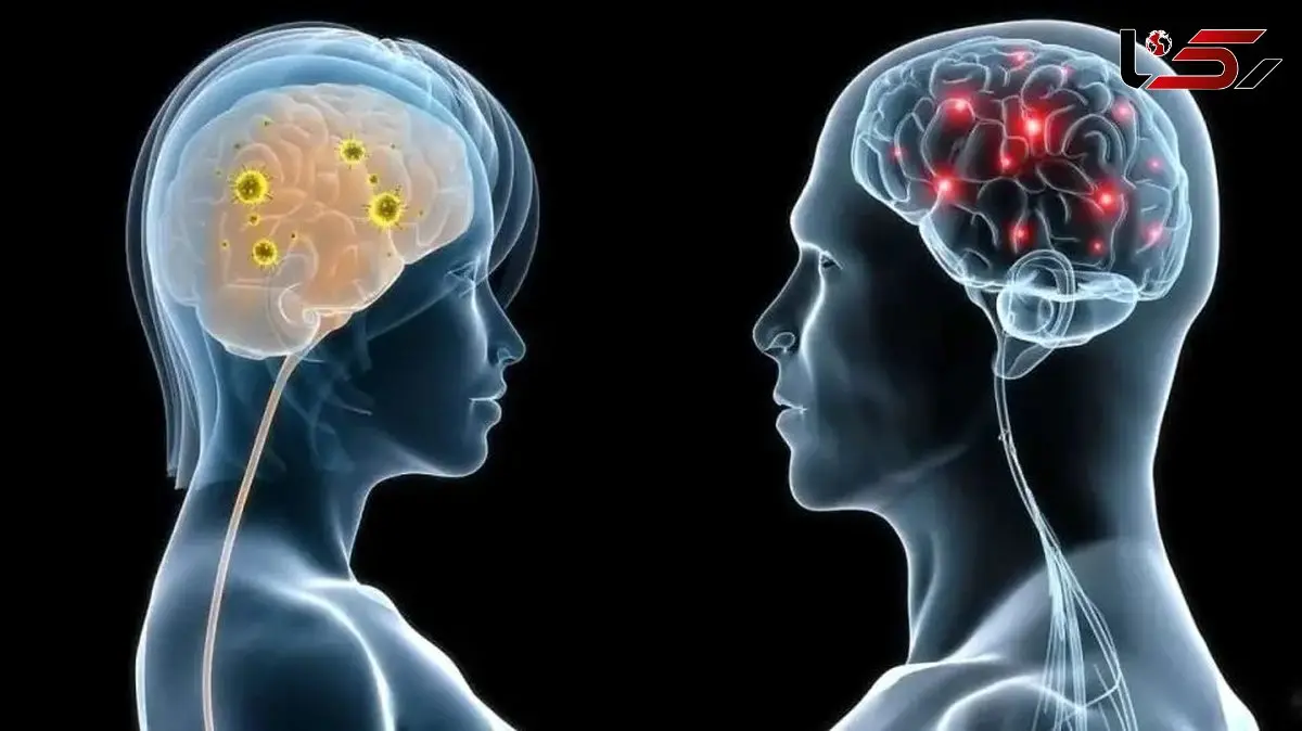 تفاوت عملکرد صدها ژن در مغز مردان و زنان