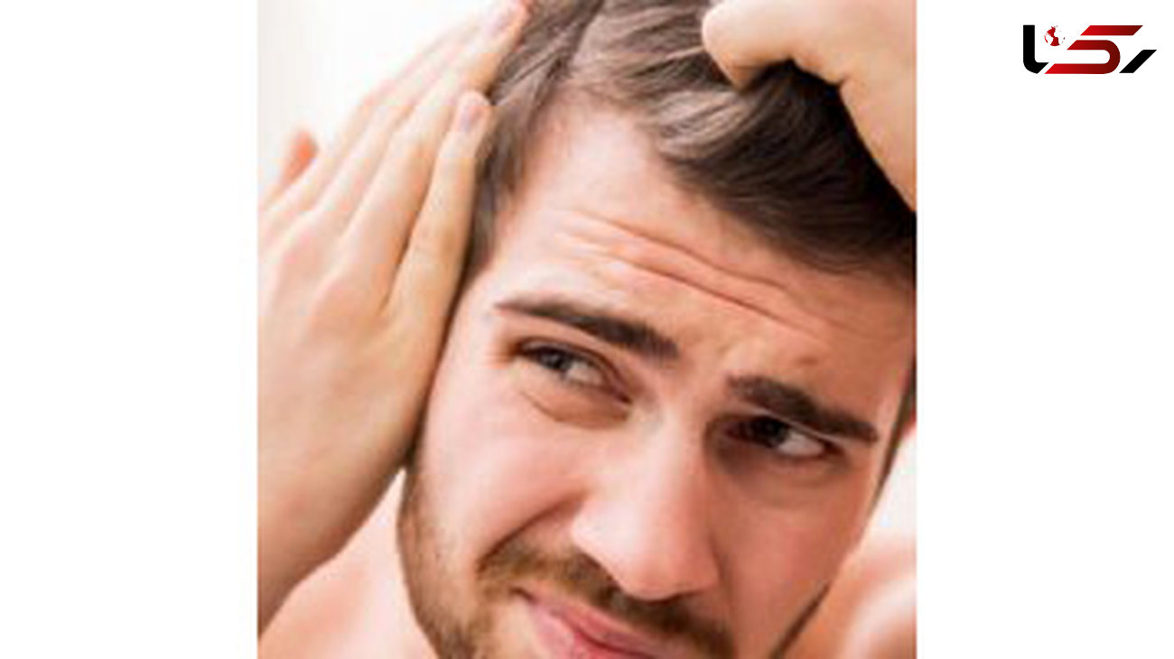 دلایل افزایش ریزش مو در تابستان 