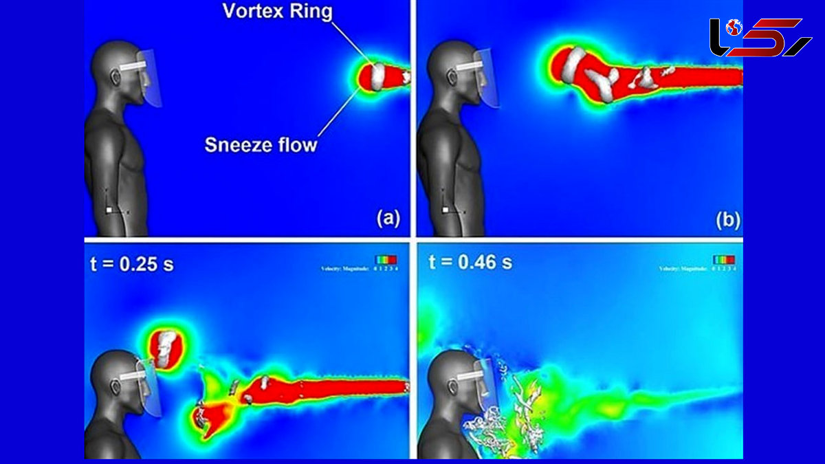  Plastic Face Shields Do Not Protect against COVID-19 