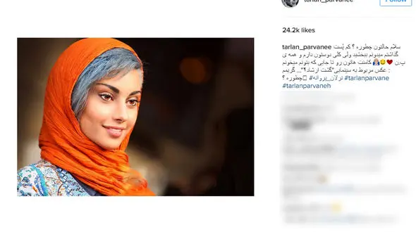 ترلان پروانه با رنگ موهای عجیب و کاملا متفاوت به اینستاگرام بازگشت +عکس 