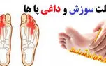علت سوزش کف پا در شب چیست؟ + جدول جامع 