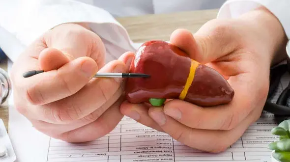 علائم کبد چرب روی پوست