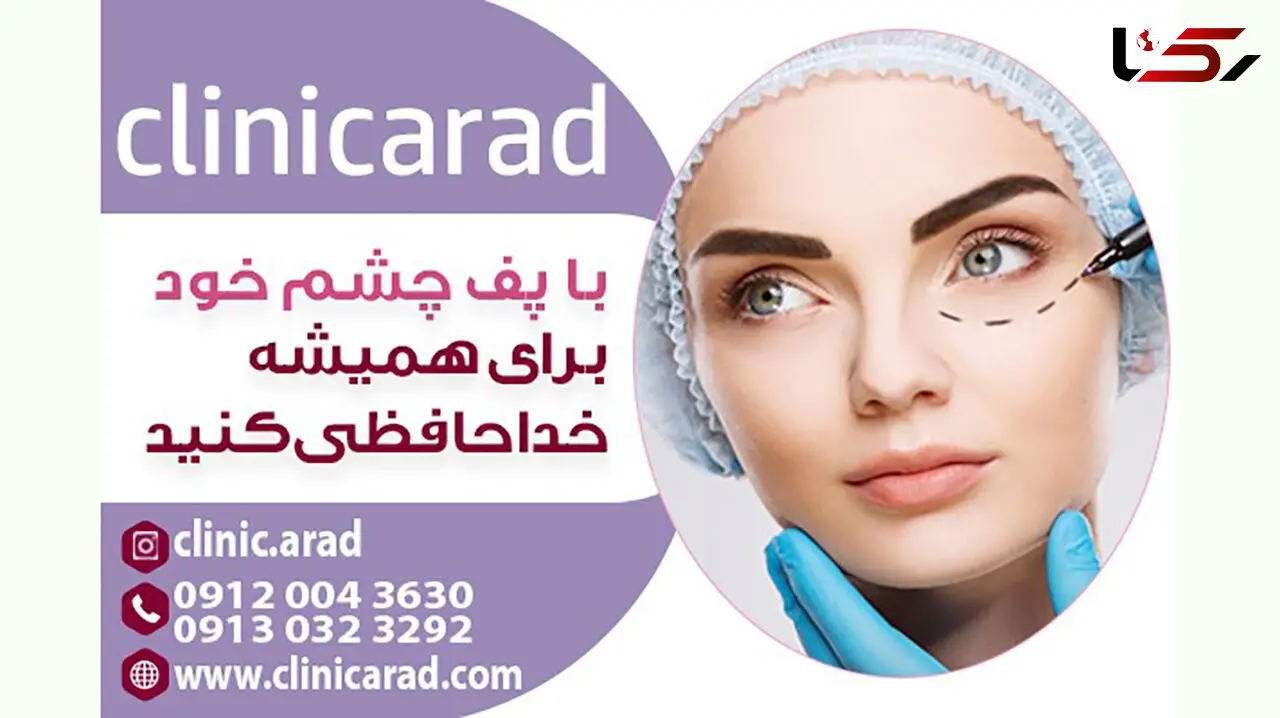 با پف چشم خود برای همیشه خداحافظی کنید