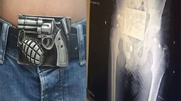 حادثه عجیب در بیمارستان دولتی / کمربند جوان آذری همه را شوکه کرد + عکس