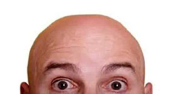 جلوگیری از طاسی سر  با گیاه جادویی