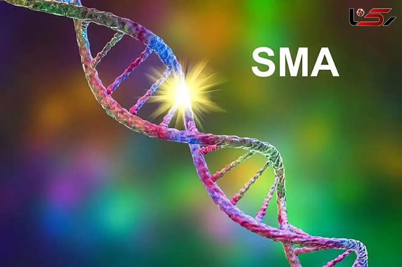 غربالگری بیماری SMA از امسال با کیت تشخیصی ایرانی