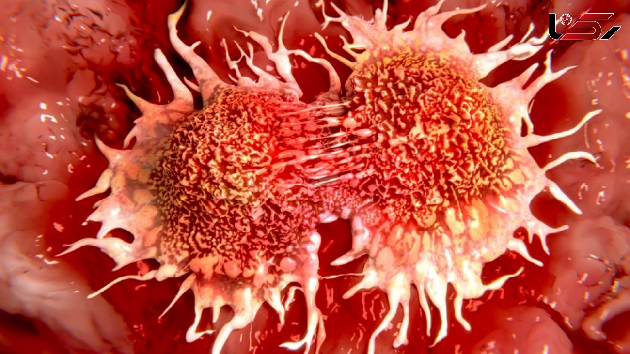 آیا سرطان پستان در مردان نادر است؟