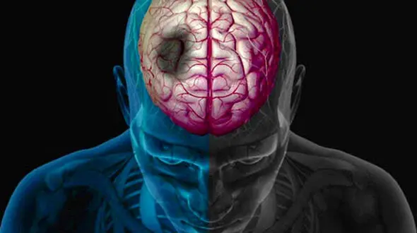 رابطه تزریق واکسن آنفلوانزا و کاهش خطر سکته مغزی