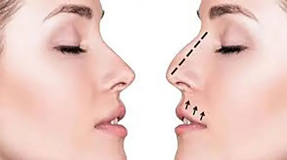 بینی لیرزی،یک دروغ بزرگ!