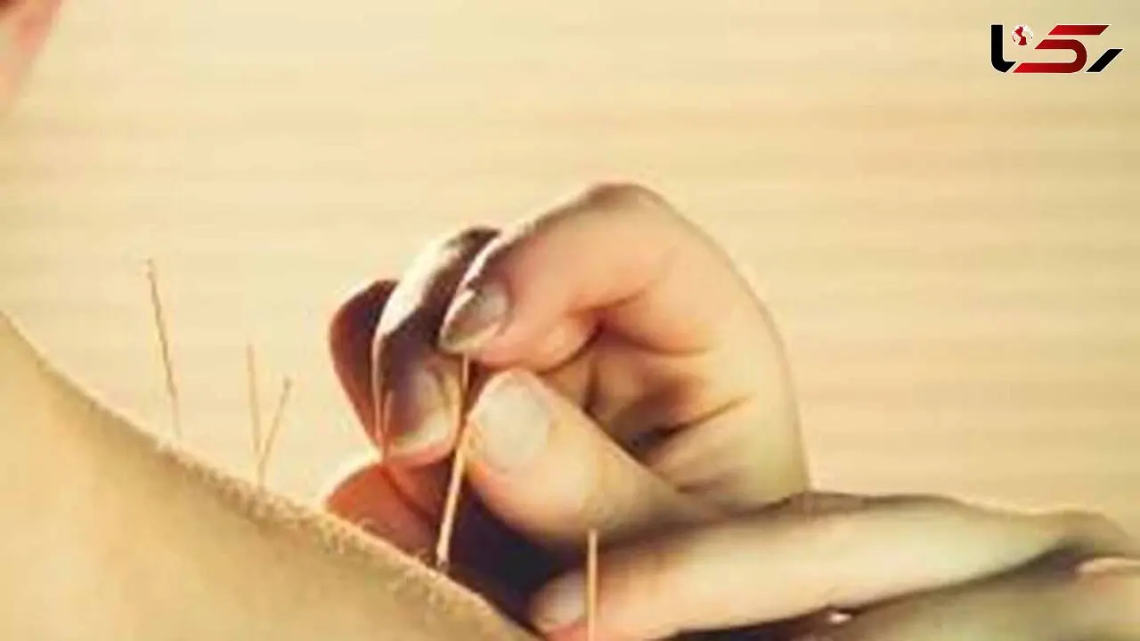 طب سوزنی و دیابت؛ هر آنچه باید بدانید