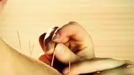 طب سوزنی و دیابت؛ هر آنچه باید بدانید