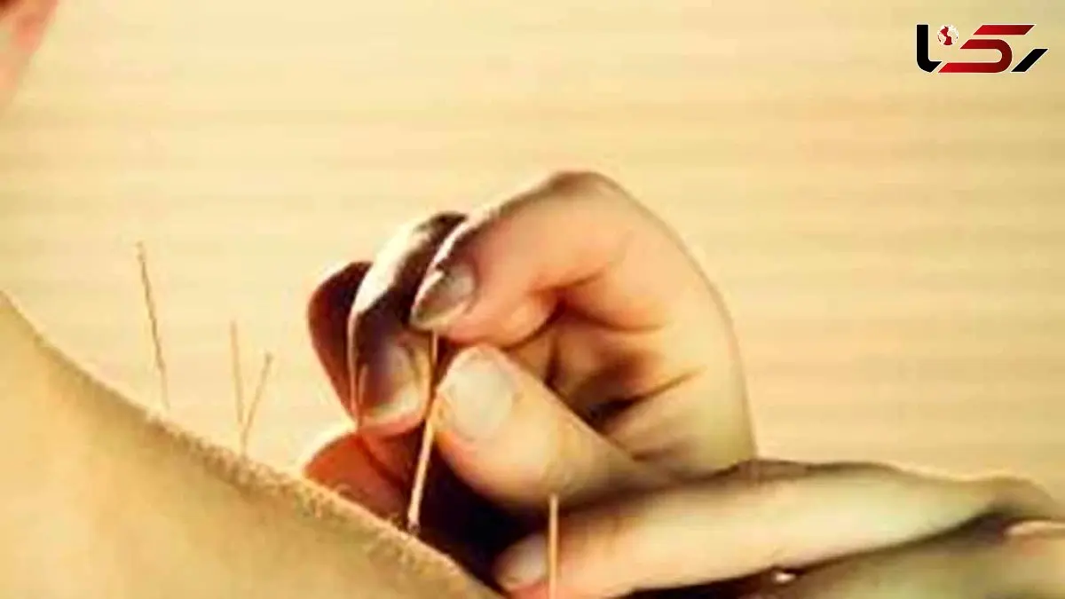 طب سوزنی و دیابت؛ هر آنچه باید بدانید