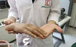 تامین 30 درصد نیاز پروتز و توانبخشی کشور تنها در چند اتاق هلال احمر / سال گذشته 15 هزار خدمت ارائه شده است