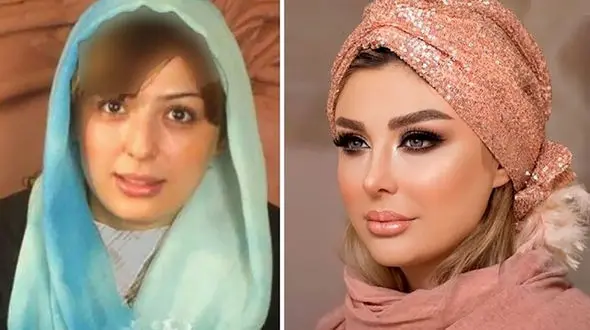 عملی ترین خانم بازیگران ایرانی / اسامی زنانی که رکودار جراحی های زیبایی اند +عکس قبل و بعد