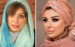 عملی ترین خانم بازیگران ایرانی / اسامی زنانی که رکودار جراحی های زیبایی اند +عکس قبل و بعد