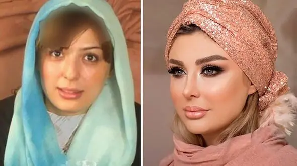 عملی ترین خانم بازیگران ایرانی / اسامی زنانی که رکودار جراحی های زیبایی اند +عکس قبل و بعد