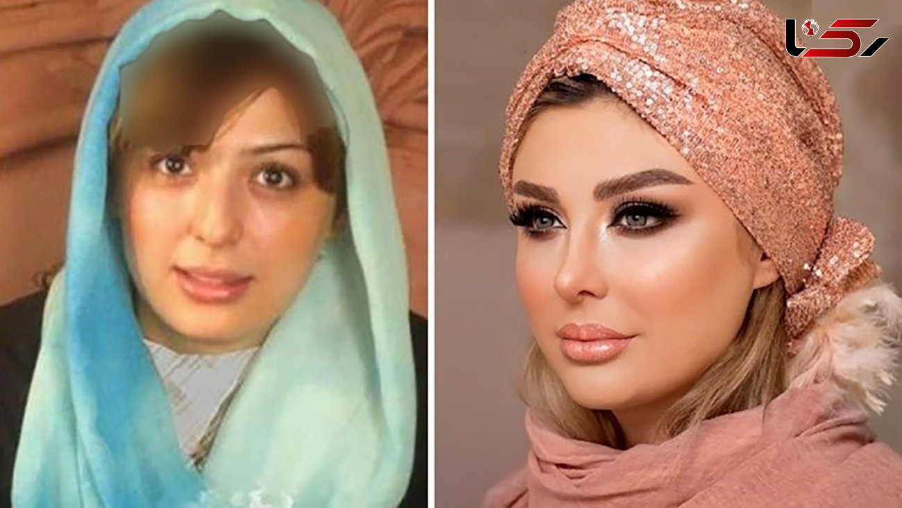عملی ترین خانم بازیگران ایرانی / اسامی زنانی که رکودار جراحی های زیبایی اند +عکس قبل و بعد