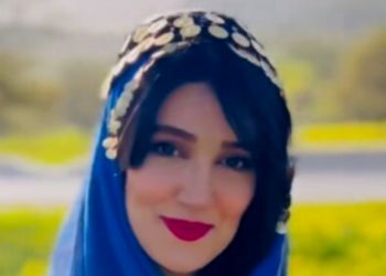 نگاهی به عمل‌های زیبایی زهرا نادری‌فر، هوژان سریال ناریا از زبان خودش