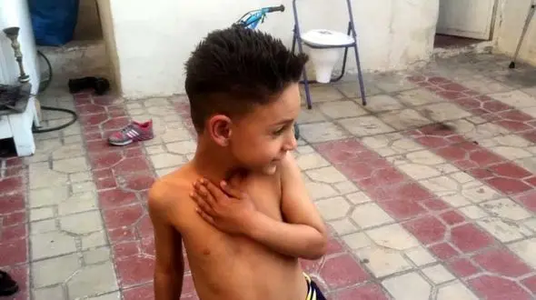 تفاوت کودک بیش فعال با کودک کم تمرکز چیست؟