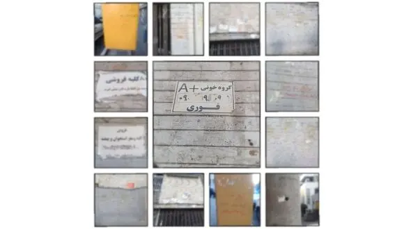 فیلم / پشت پرده  فروش قلب یک مرد در تهران / وزارت بهداشت پاسخ داد