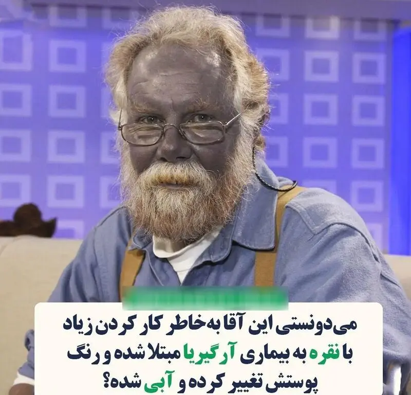 مرد نقره کار