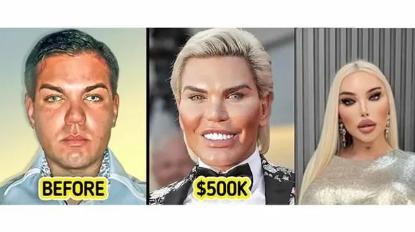 باربی مرد زن شد و دنبال شوهر است + فیلم رکورد دار عمل زیبایی جهان! / هوش از سرتان می پرد!