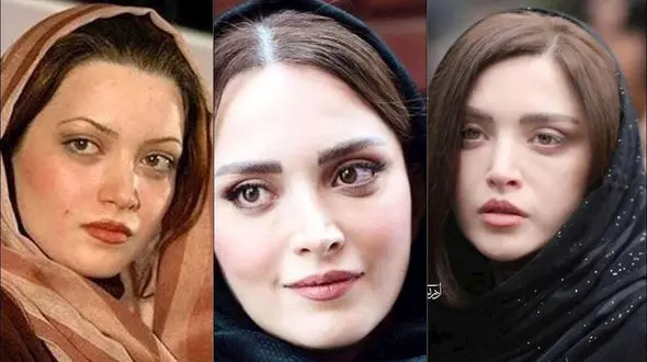 صفر تا صد عمل های زیبایی بهنوش طباطبایی 