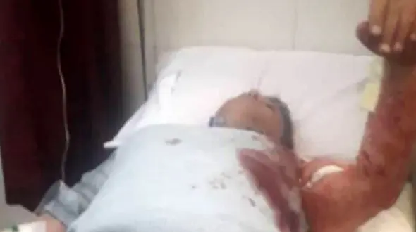 چاقو کشی مالک متخلف یک ساختمان برای مامور شهرداری تبریز + عکس