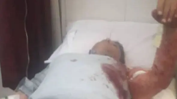 چاقو کشی مالک متخلف یک ساختمان برای مامور شهرداری تبریز + عکس