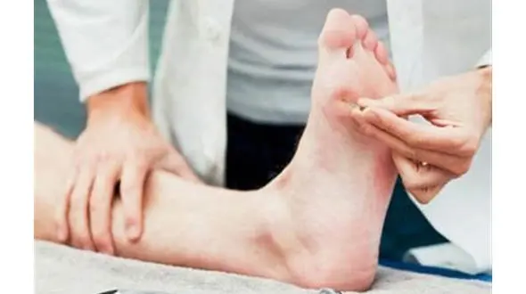 بیماری برگر چیست؟/مبتلایان به این بیماری سیگاری هستند