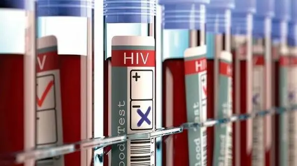  آمار تکان دهنده از مبتلایان به بیماری ایدز