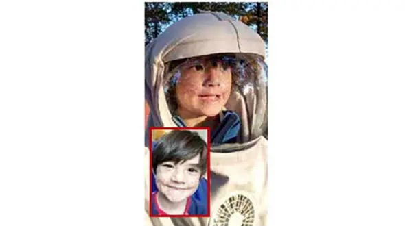 این پسربچه با نور خورشید می میرد + عکس