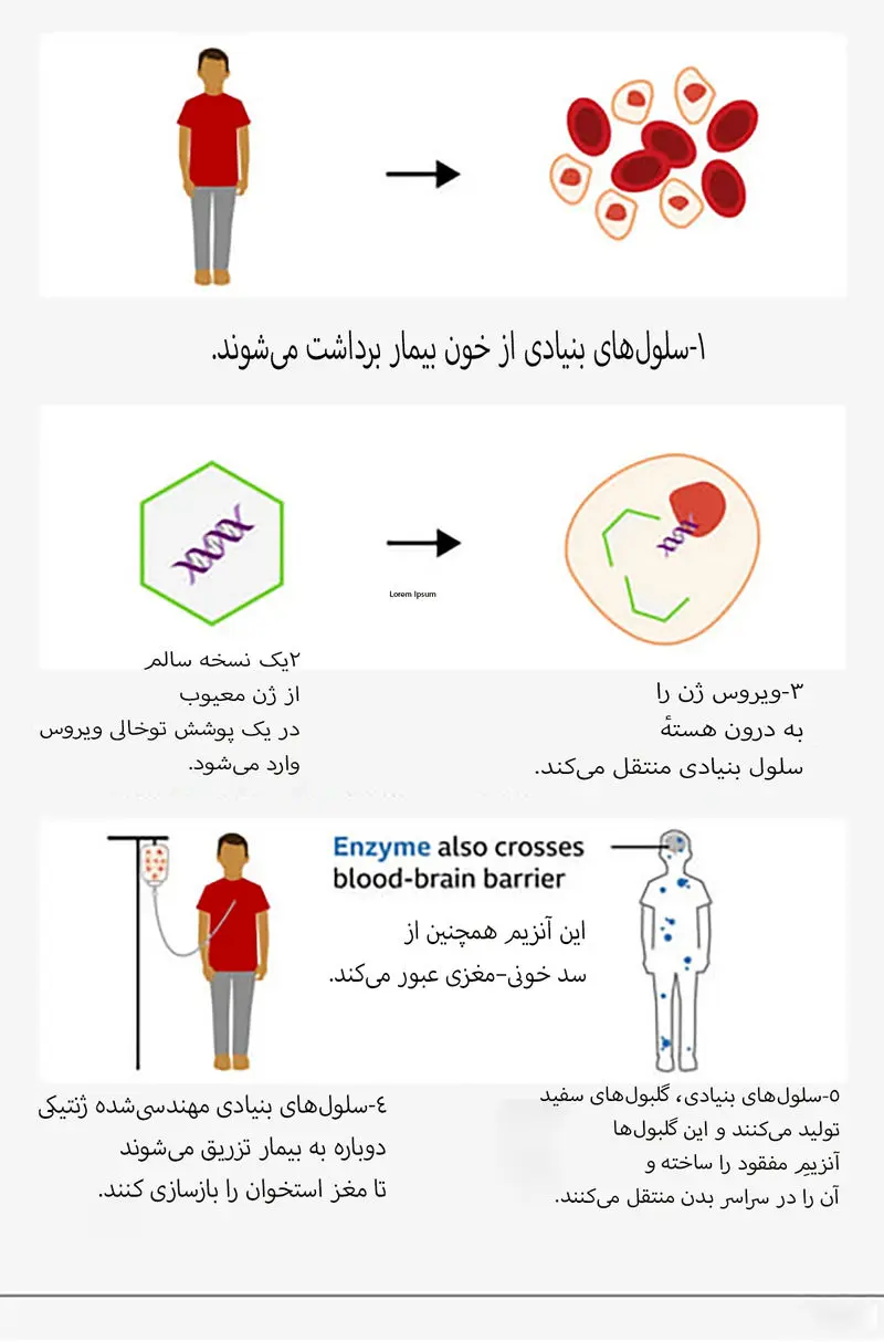 Boy with rare condition5