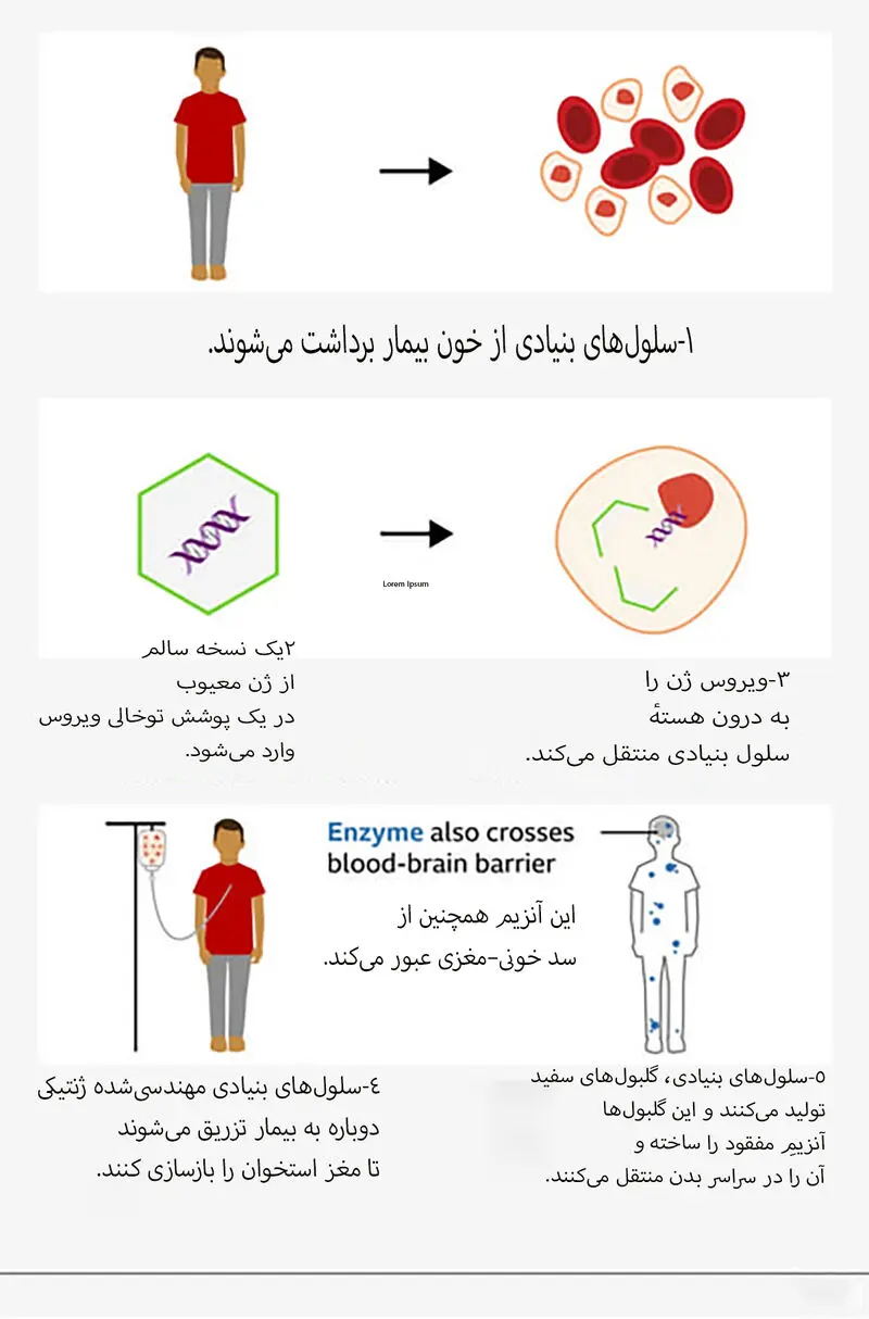 Boy with rare condition5