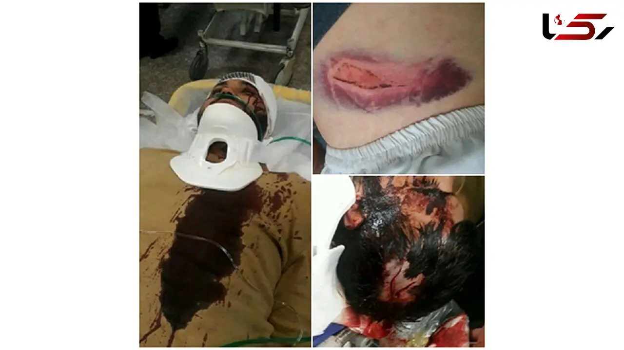 بازداشت عاملان حمله خونین به روحانی کرجی / دادستان :اغماض نمی کنیم + فیلم
