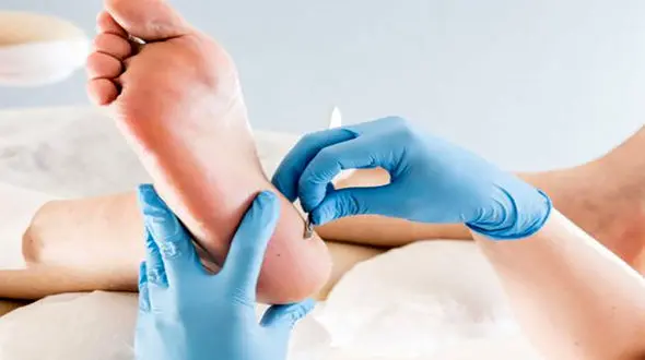 زخم‌های دیابت را با شیره این درخت درمان کنید