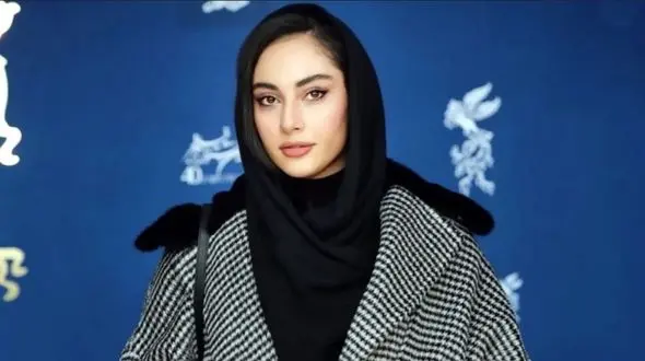 تغییر چهره عجیب و مینیاتوری ترلان پروانه + عکس قبل و بعد!